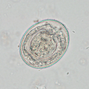 Case425_F.jpg