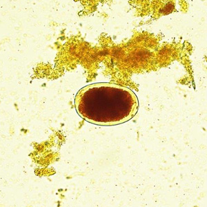 Case427_A.jpg