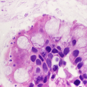 Case428_A.jpg