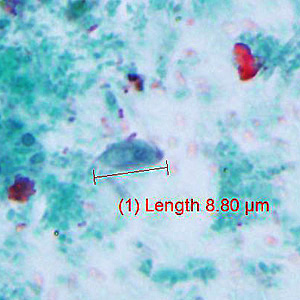 Case429_C.jpg