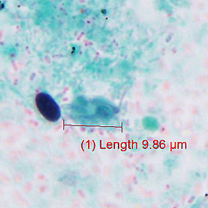 Case429_D.jpg
