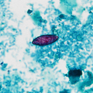 Case430_D.jpg