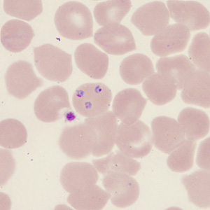 Case431_C.jpg