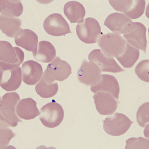 Case431_D.jpg