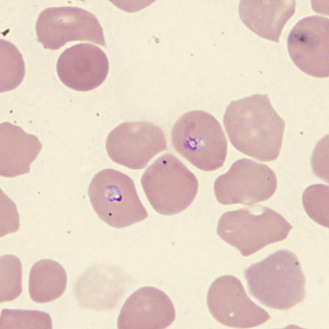 Case431_E.jpg