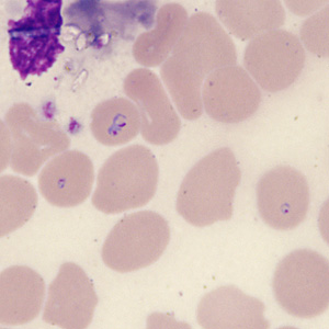 Case431_G.jpg