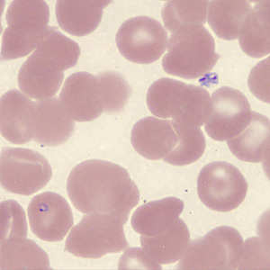 Case431_I.jpg