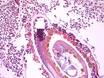 Case432_B.jpg