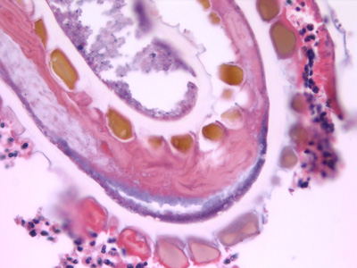 Case432_E.jpg