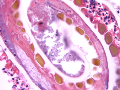 Case432_F.jpg