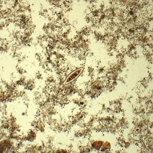 Case433_A.jpg