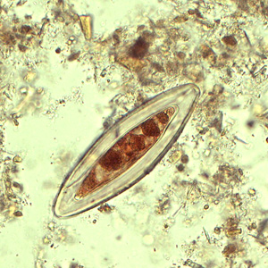 Case433_B.jpg