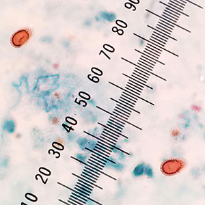 Case434_A.jpg