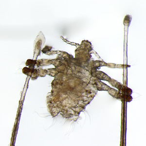 Case435_C.jpg