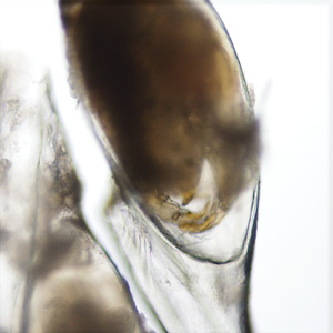 Case435_F.jpg