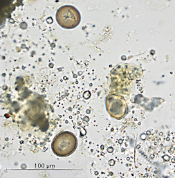 Case438_A
