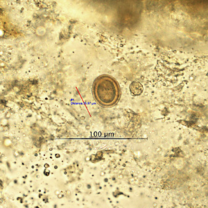 Case438_B