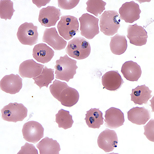 Case439_A