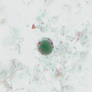 case440_A