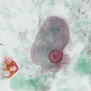 case440_B