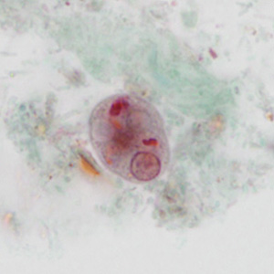 case440_C1