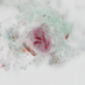 case440_C2