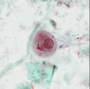 case440_E1