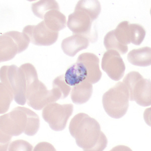Case443_E Case 443