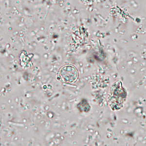 Case445_B Case445