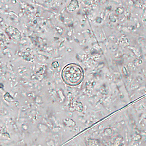 Case445_D Case445