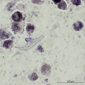 OLYMPUS DIGITAL CAMERA Parasitic image