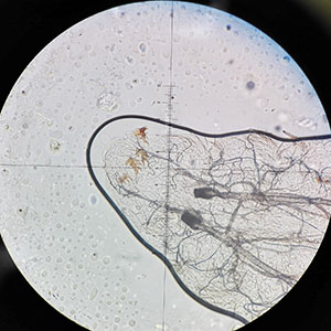 Case476_D parasitic image