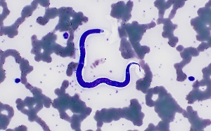 parasitic image