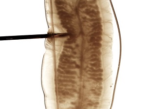 Case489_C Figure C