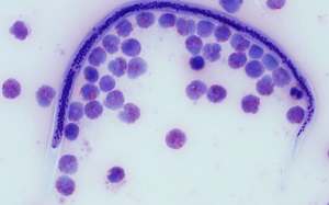 Case491_B Figure B