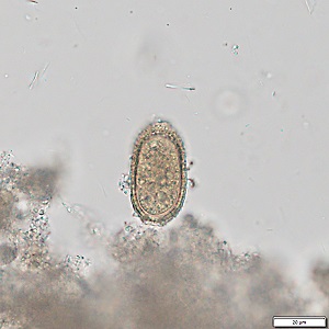 Case492_B Figure B