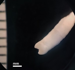 Case493_B Figure B