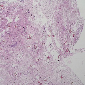 Case495_A Figure A