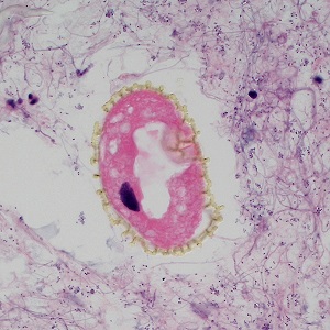 Case495_B Figure B