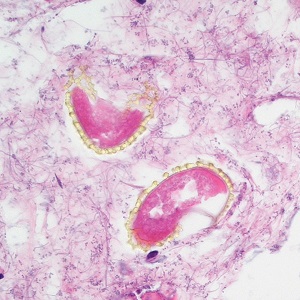 Case495_C Figure C