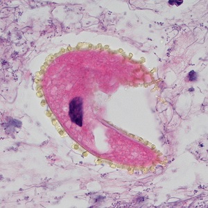 Case494_A Figure D