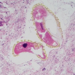 Case495_E Figure E