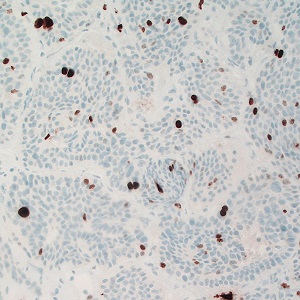 Case495_F Figure F