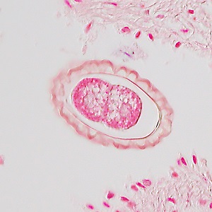 Case495_J Figure J