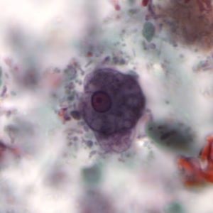 Case497_D Figure D