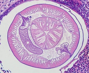 Case498_B Figure B