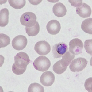 Case499_B Figure B