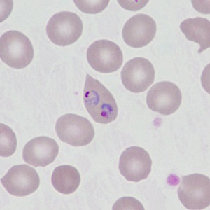 Case499_F Figure F