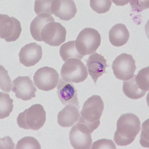 Case499_G Figure G