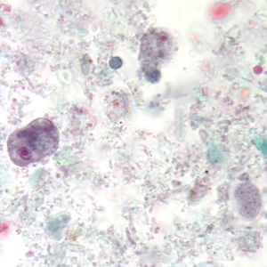 Case_503_B Figure B